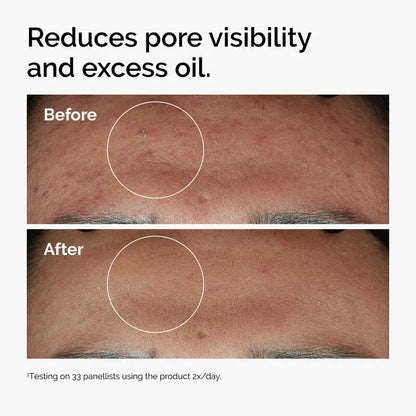 Niacinamide Serum - Niacinamide 10% Zinc 1%